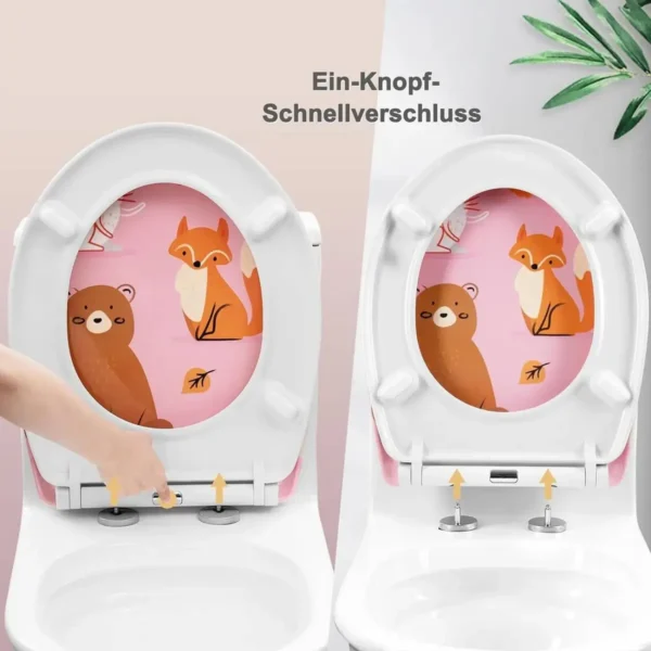 Diferza Toiletdeksel, Toiletbril Met Softclose-mechanisme, Toiletbril, O-vorm, Roze Cartoonpatroon 6